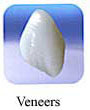 dental veneer